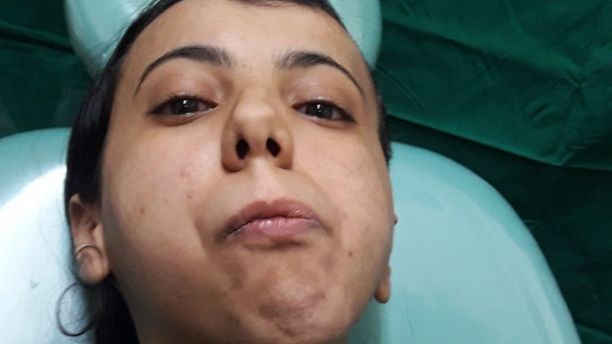 A woman has eaten solid food for the first time in her life - 30 years after her jaw was fused shut by a tumour. See story SWJAW, Fatima, 30, from Yemen, couldn't open her mouth and had to exist on a liquid diet, before she visited Indian doctors looking for a cure.Surgeons found a benign tumour on her jaw joint which they removed in a four-hour operation.The grateful woman said she couldn't wait to "scream my lungs out" and has already tucked into solid food for the first time in her life.She said: "For most people, opening their mouth, chatting and relishing on sumptuous food is a normal way of life. "In the past three decades, this is the first time I open to my mouth, eat food and enjoy its taste, and talk to my friends and family. "The opening of the mouth has opened the entire world for me.
