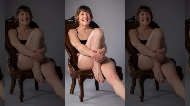 Sharon Donnelly, 54 on her nude photo shoot. See Masons copy MNFLATTIE: A brave woman who had both breasts removed due to cancer took part in a nude photo shoot and says sheâs now âa happy flattieâ. Sharon Donnelly, 54, said she had to fight to have her second breast removed as she feared her cancer would return. She said doctors told her it was healthy and initially refused to do the second operation. But after battling the decision for months and finally convincing them to operate, she claims doctors discovered cancerous tissue in the remaining breast.