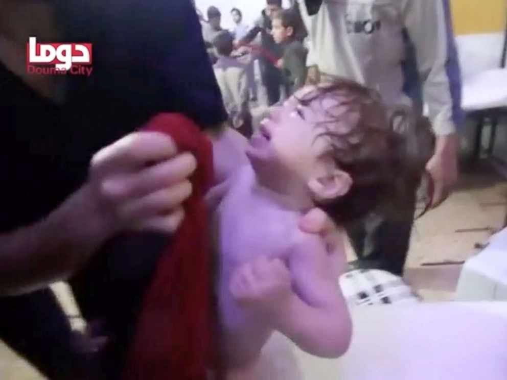 PHOTO: A child cries as they have their face wiped following alleged chemical weapons attack, in what is said to be Douma, Syria in this still image from video obtained by Reuters, April 8, 2018.