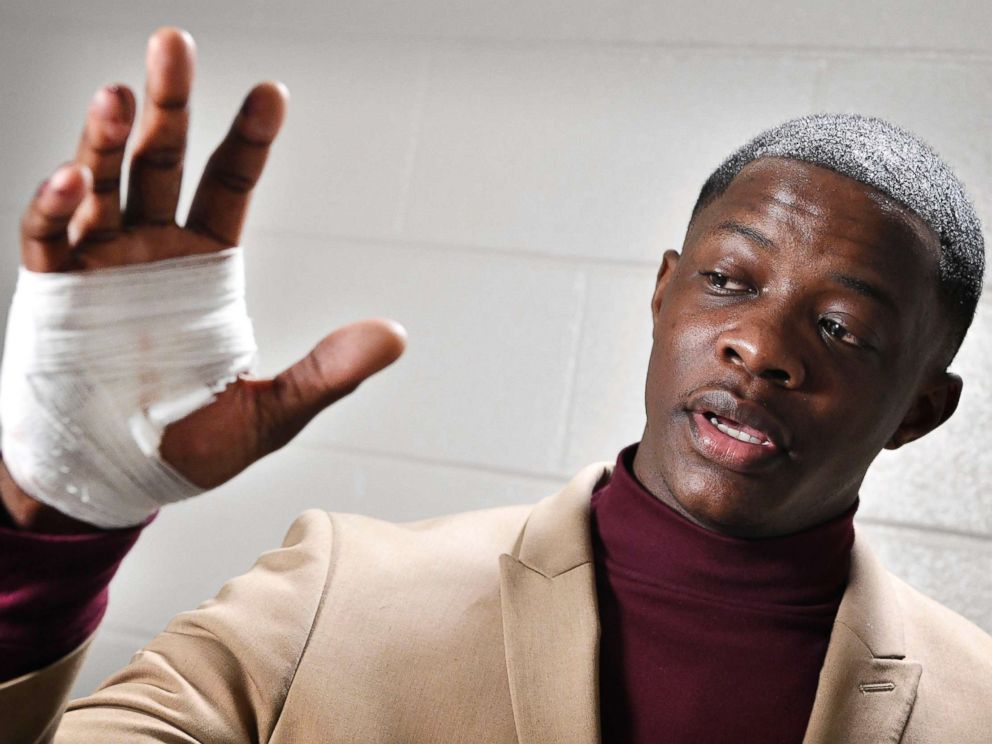 PHOTO: James Shaw Jr., 29, shows his hand that was injured when he disarmed a shooter inside an Antioch Waffle House, April 22, 2018 in Nashville, Tenn.