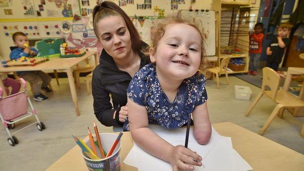 Lily-Mai White, with mum Hannah White, is fiited with a newprosthetic arm fitted by  Mark Bryant at Middleton pre-school at Bretton, Peterborough. See Masons copy MNARM: A four-year-old girl who was born without a forearm has been transformed in a Disney princess  - thanks to a prosthetic arm which features a Frozen-themed design. Experts have printed Lily-Mai Drummond a 3D replica arm with a snowflake design like the one featured on Queen Elsa's dress in the hit movie. Lily-Mai was born without the limb due to complications in the womb. But after having the Â£1,000 purple glittering prosthetic hand fitted this week, the youngster will now be able to get herself ready for her first day at school in September. 