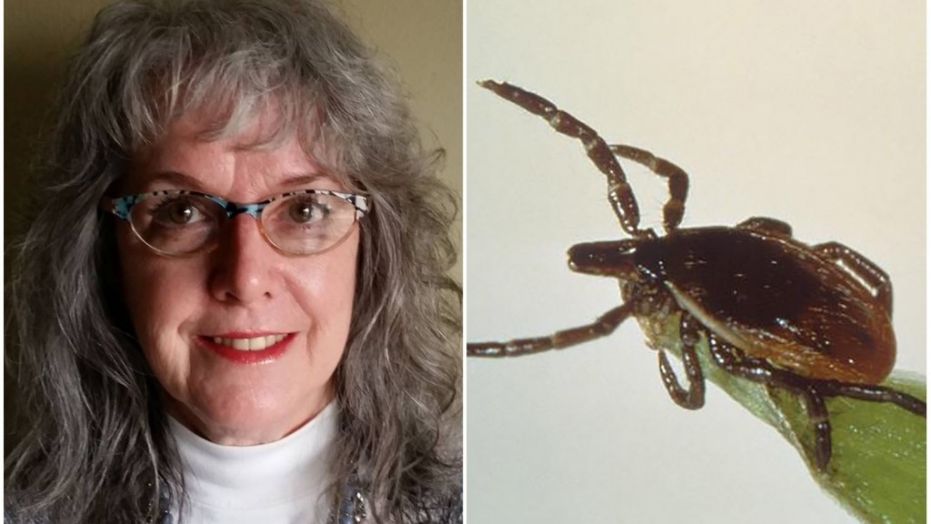 Jennifer Burton says she developed the "red meat allergy" known as alpha-gal after getting bitten by a tick.
