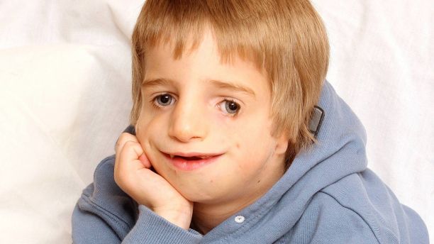 Anti bullying campaigner Ashley Collins who has Treacher Collins syndrome - he is pictured here aged 6. See SWNS story SWBULLY; A teenage anti-bullying campaigner with a rare genetic disorder which causes facial deformity was "insulted" after being contacted by Channel 4 show - The Undateables. Brave Ashley Carter, 17, was born with Treacher Collins syndrome and was bullied as a child before becoming an anti-bullying campaigner. He has appeared on shows such as Loose Women, The Jeremy Kyle Show and ITV News West Country to share his story. But he was horrified to receive an email from Channel 4 researcher for The Undateables, described as a âdocumentary series following people with challenging conditions who are looking for love.â