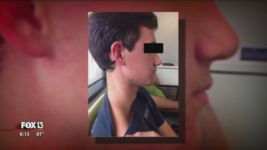  Unidentified teen went to a walk-in clinic exhibiting a fever and rash.