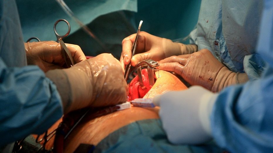 A Tennessee man died roughly a month after a surgeon lost a surgical needle inside his body while performing open-heart surgery.