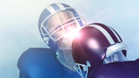 Kickoff rule tied to fewer concussions, new research says