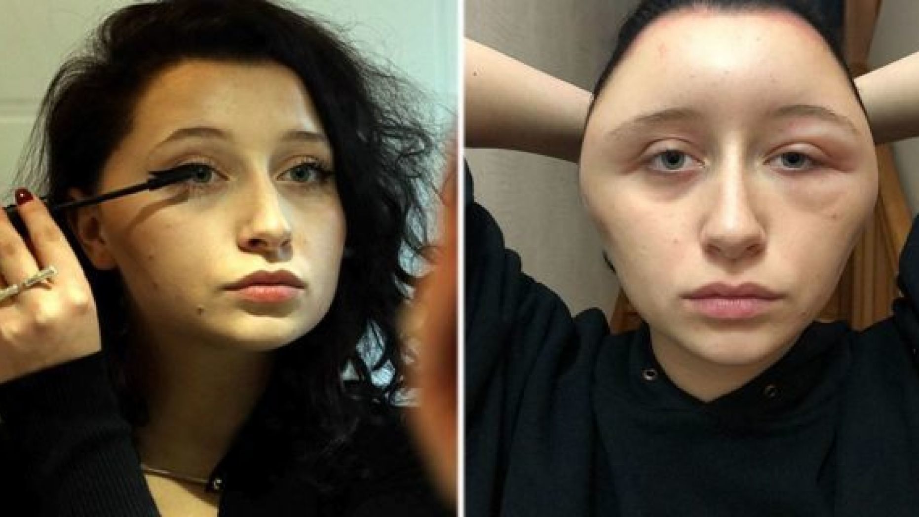 A French woman says her head became swollen after she suffered an allergic reaction to hair dye.