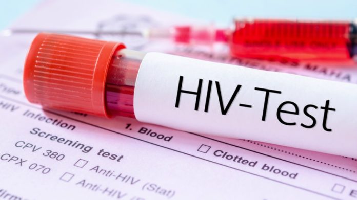 HIV test thegrio.com