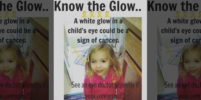 The picture that showed the cancer behind Gracie Corrigan's eye
