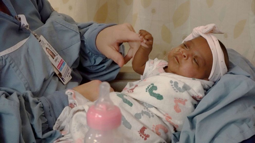PHOTO: Saybie, the worlds smallest surviving baby who was born at .5 pounds in San Diego, California, has been discharged from the hospital five months after her birth.