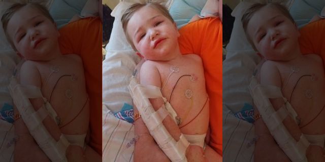 The toddler developed a rash after he was bitten by a tick infected with RMSF, his mother said. (Kayla Oblisk)