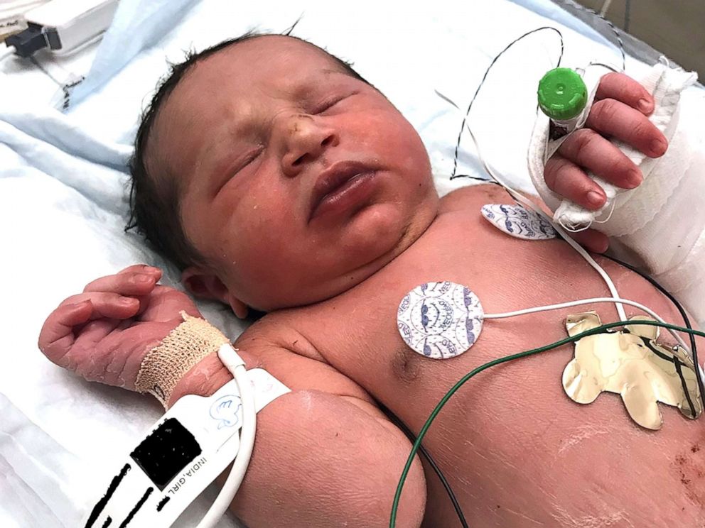 PHOTO: This photo released by the Forsyth County Sheriffs Office shows a newborn baby girl found alive in a plastic bag in a wooded area in Cumming, Ga., by Forsyth County deputies Thursday, June 6, 2019.