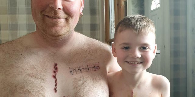 Martin Watts got inked with the tattoo to match his son Joey, who underwent a life-saving open heart surgery at Leeds Children's Hospital four weeks ago.