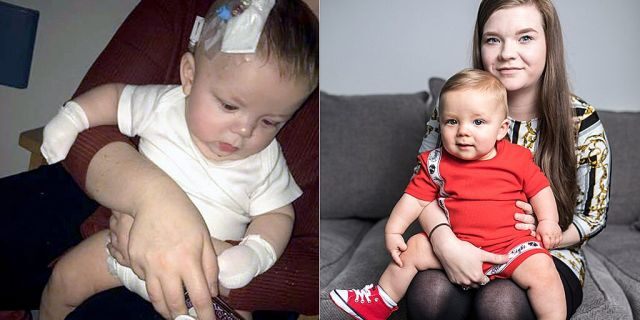 Noah, pictured during his recurrence in March, and right healthy, allegedly contracted the virus from an infected person at a christening.