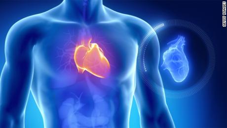 Evolution may be why humans are prone to heart attacks, study says
