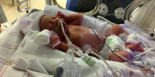 Jayden was born weighing 3 pounds, 9 ounces, and was estimated to be 30 weeks gestation. 