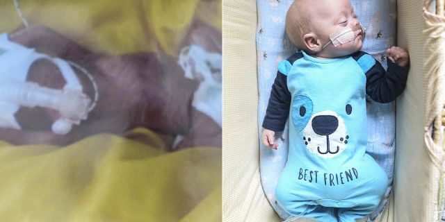 Murphy, pictured left shortly after his birth and right at home, spent 98 days in the NICU before being discharged.