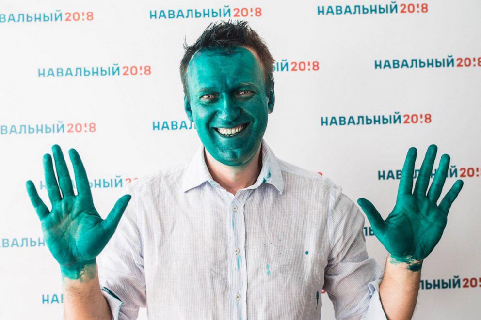 PHOTO: Alexei Navalny, founder of the Anti Corruption Foundation, smiles after a press conference on the opening of a presidential election campaign office in Barnaul, Russia, March 20, 2017, after assailants threw green dye at him.