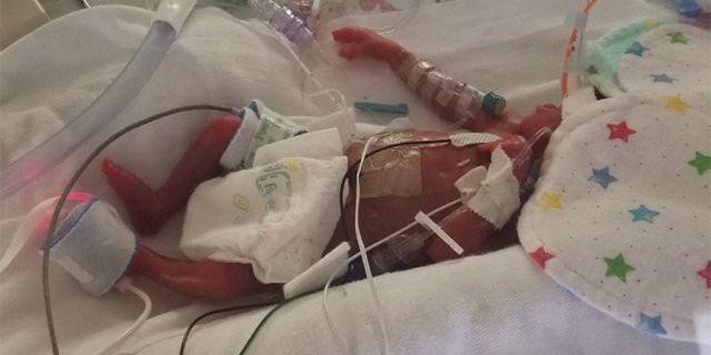 The family's fundraising page said Jaden will likely remain in the NICU until his original November due date 