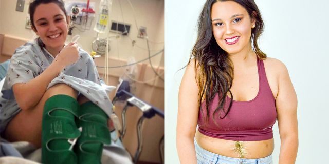 Gina Arnold underwent eight hours of surgery to get a mesh to protect her organs.