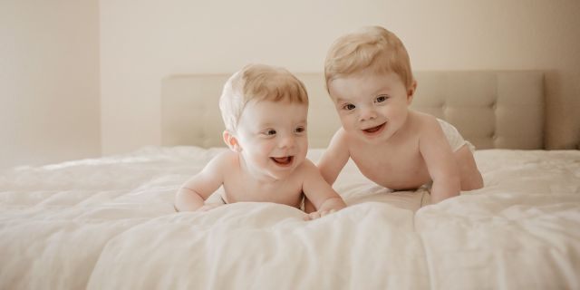 Argon and Aldridge were diagnosed with albinism at 7 months old. (SWNS)