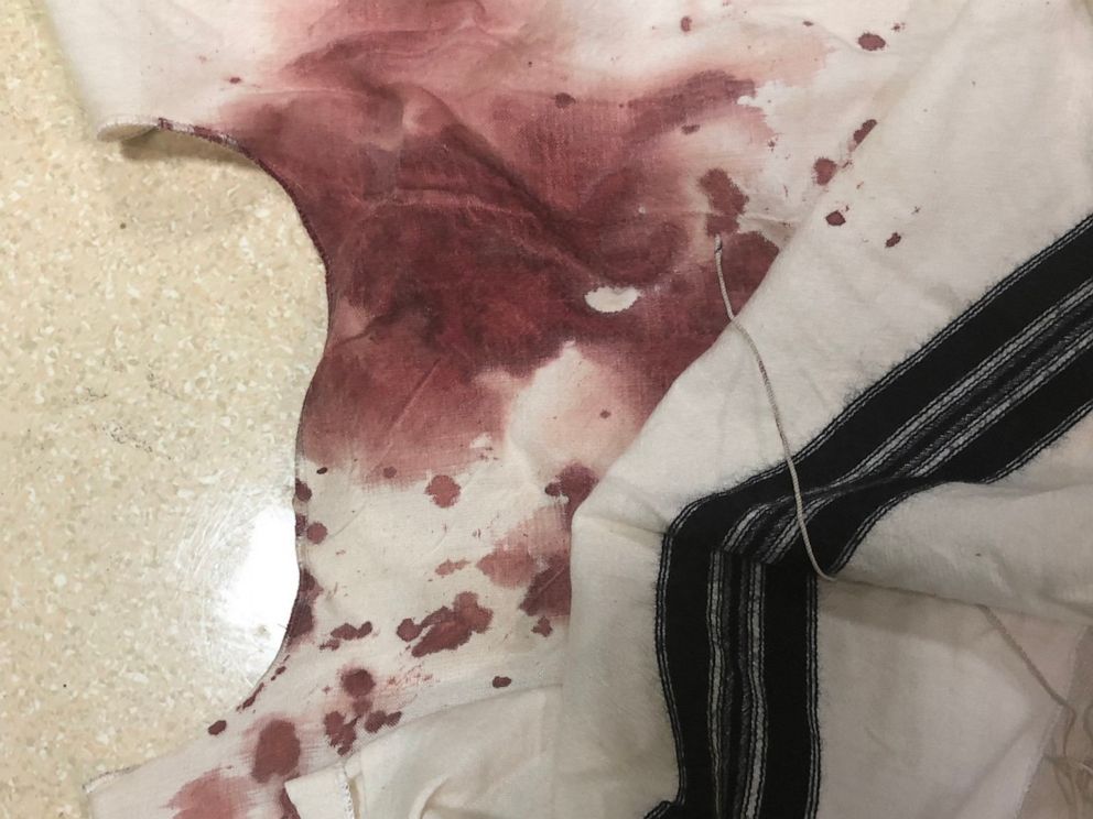 PHOTO: This photo of a bloodstained religious garment was posted to social media by Benny Friedman after his father-in-law, a Hasidic Jew, was attacked in the Brooklyn borough of New York, on Aug. 27, 2019.