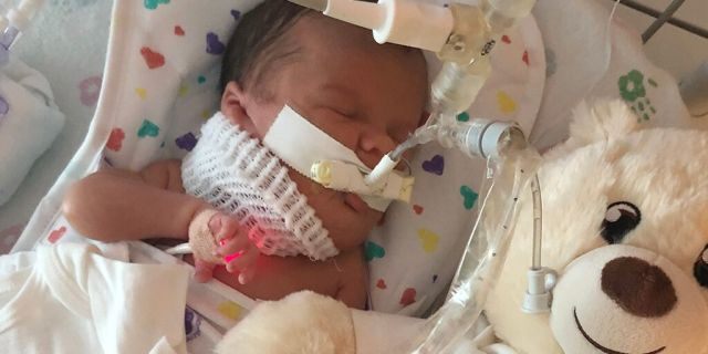 Her parents said she is expected to join her siblings at home in October, and that she is recovering well from surgery. 