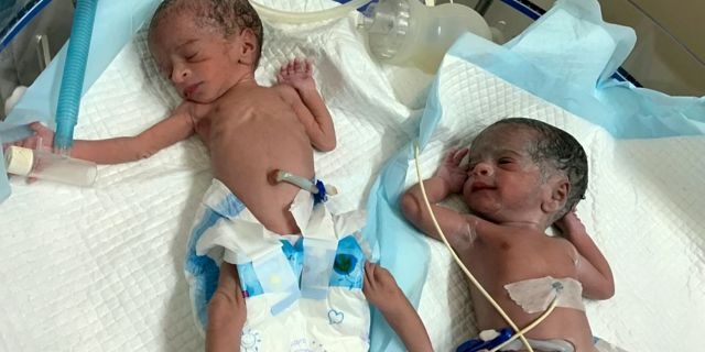 The girls were born healthy and each weighs around 4.4 pounds, hospital staff said.