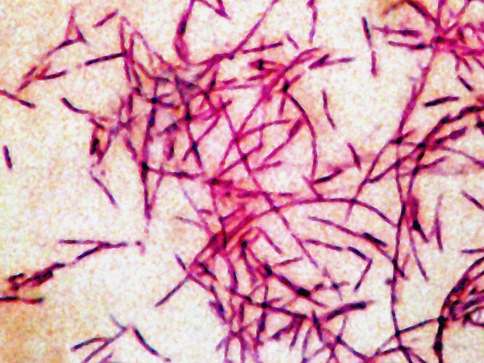 PHOTO: Legionnaires Disease bacterium is seen in this stock photo.