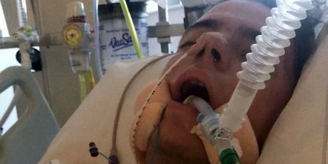 Griffin, who missed his 21st birthday while in a coma, said his symptoms started with vomiting before progressing to a severe headache and stiffness in his neck. 