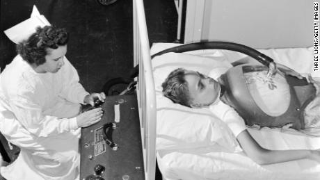 A boy suffering from polio is treated with an &quot;iron lung&quot; at a hospital in 1955, while a nurse controls the flow of air pressure. 